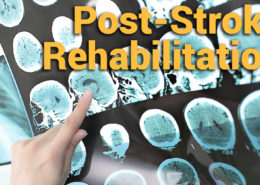 Stroke Rehabilitation