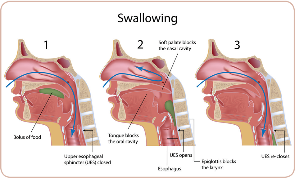 can a speech therapist help with swallowing